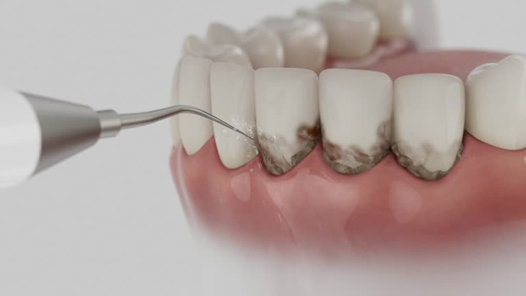Reliable Dental Implants contractor in Mercedes, TX by Smile Center Dentistry